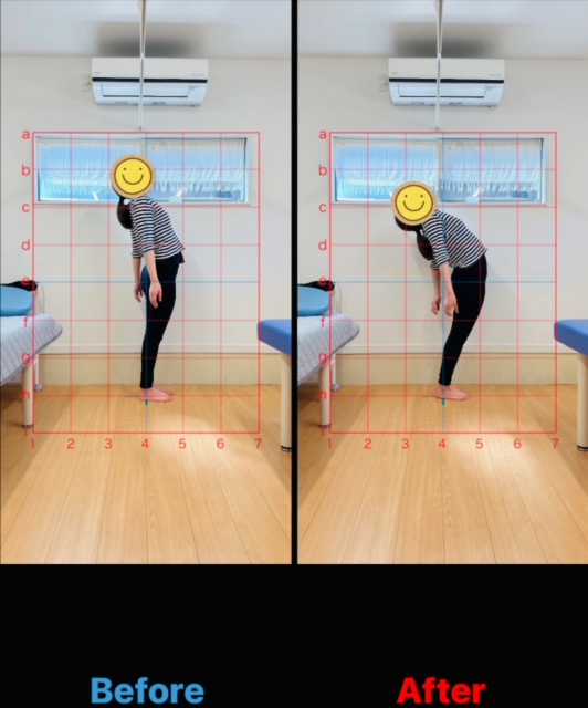 胸郭骨盤矯正（リア・ラインコア）